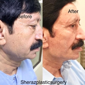 Dr Sheraz Raza