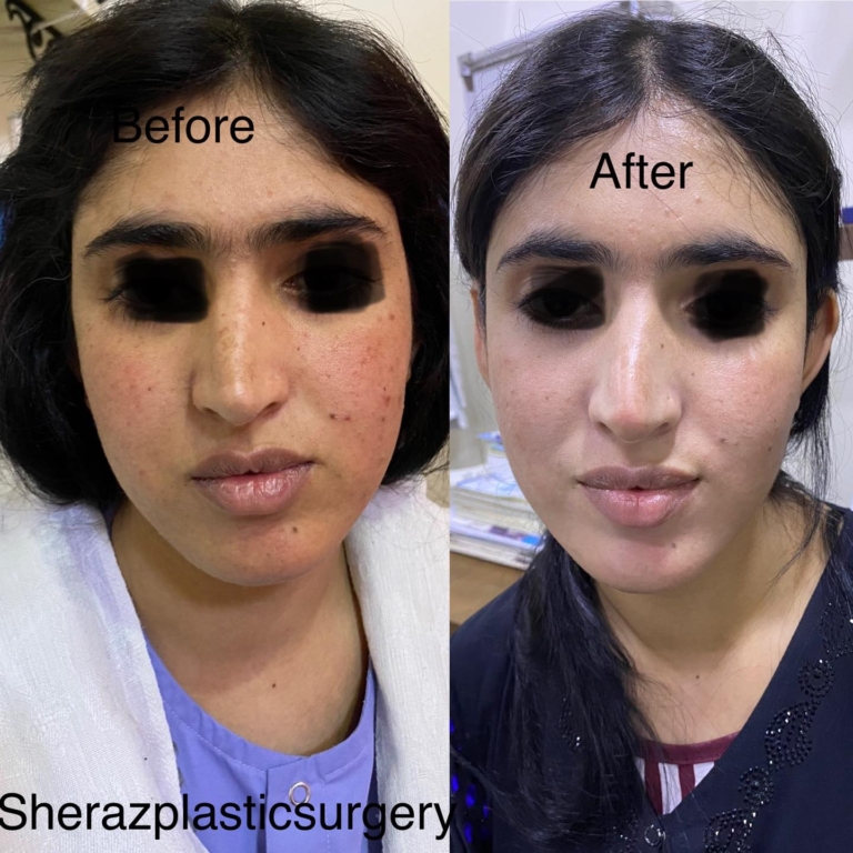 Dr Sheraz Raza Face Sheraz Plastic Surgery 4193