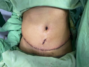 Dr Sheraz Raza Liposuction Surgeon